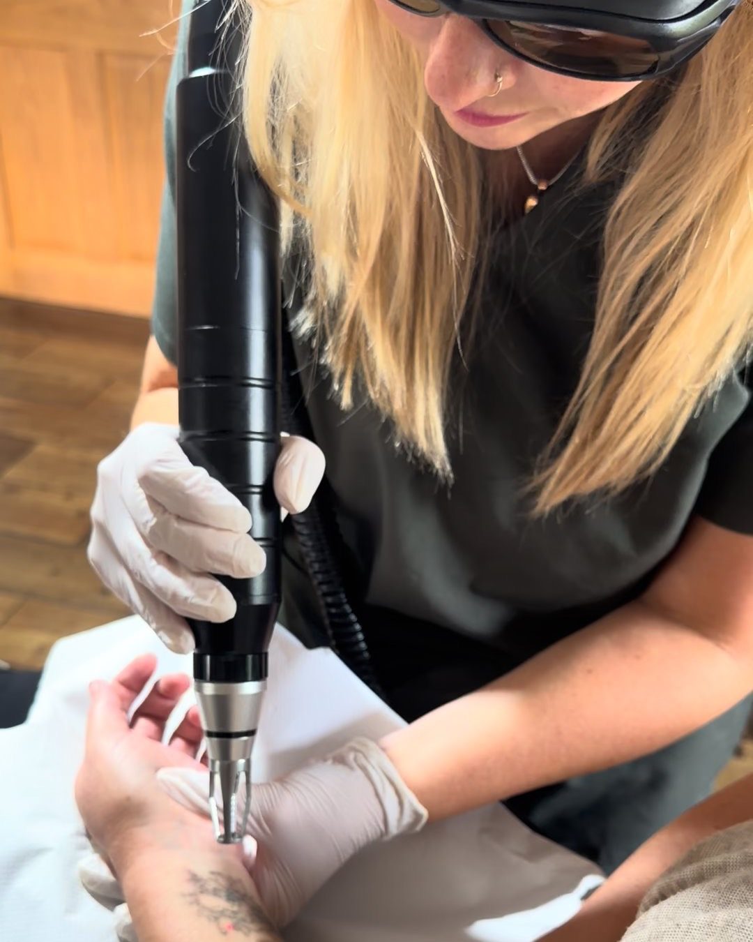 Laser tattoo removal in the treatment room at Glebe Farm