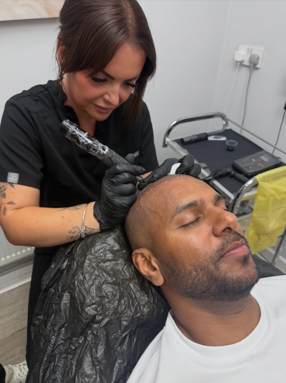 Libby Fuller, wearing black gloves, placing scalp micropigmentation along a client's hairline as he reclines with his eyes closed.